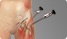 Hip Arthroscopy - Carlos Gonzalez-Sandoval,M.D.