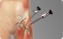 Hip Arthroscopy - Carlos Gonzalez-Sandoval,M.D.